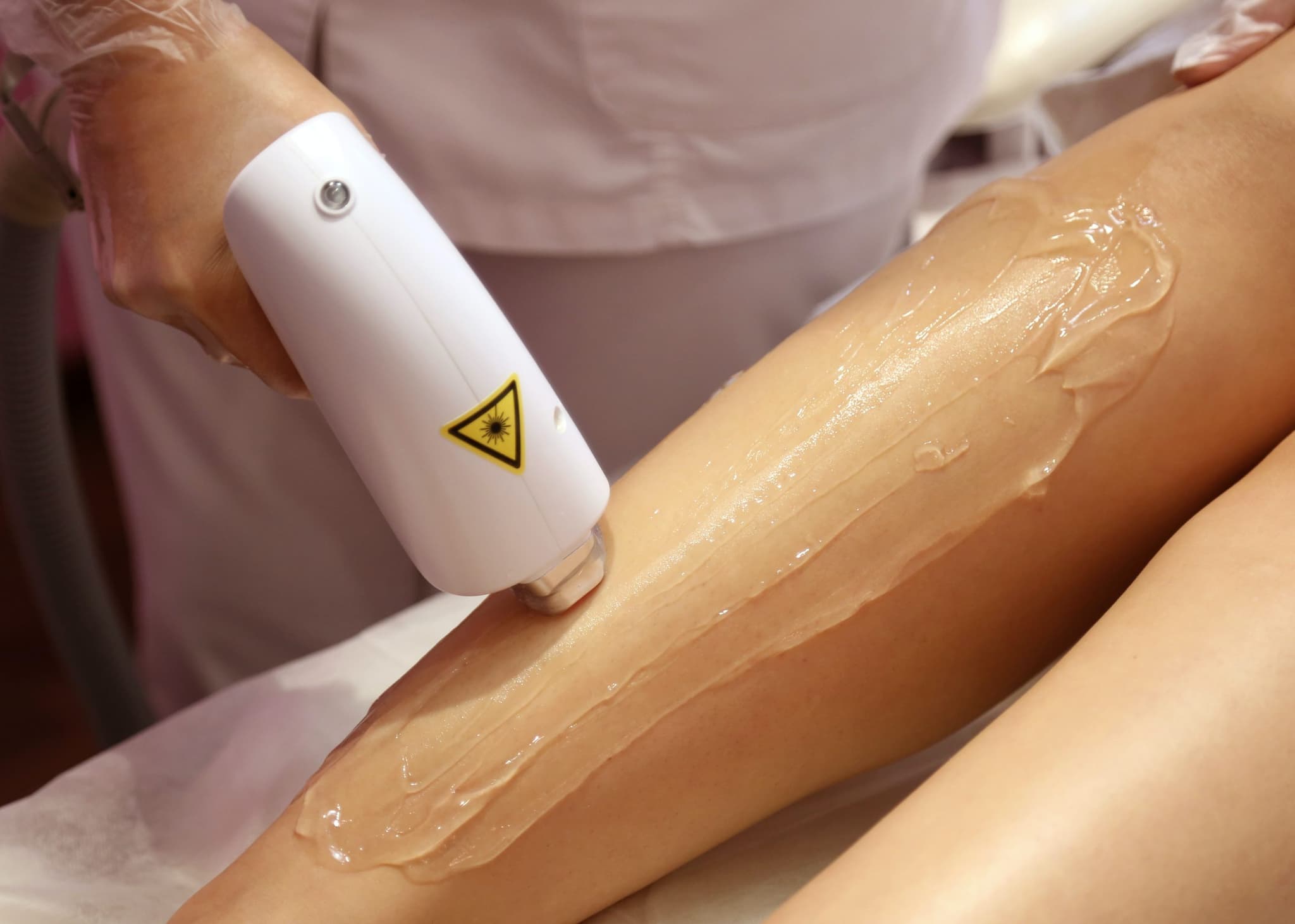 Laser Hair Removal treatment at BC Medical Aesthetic