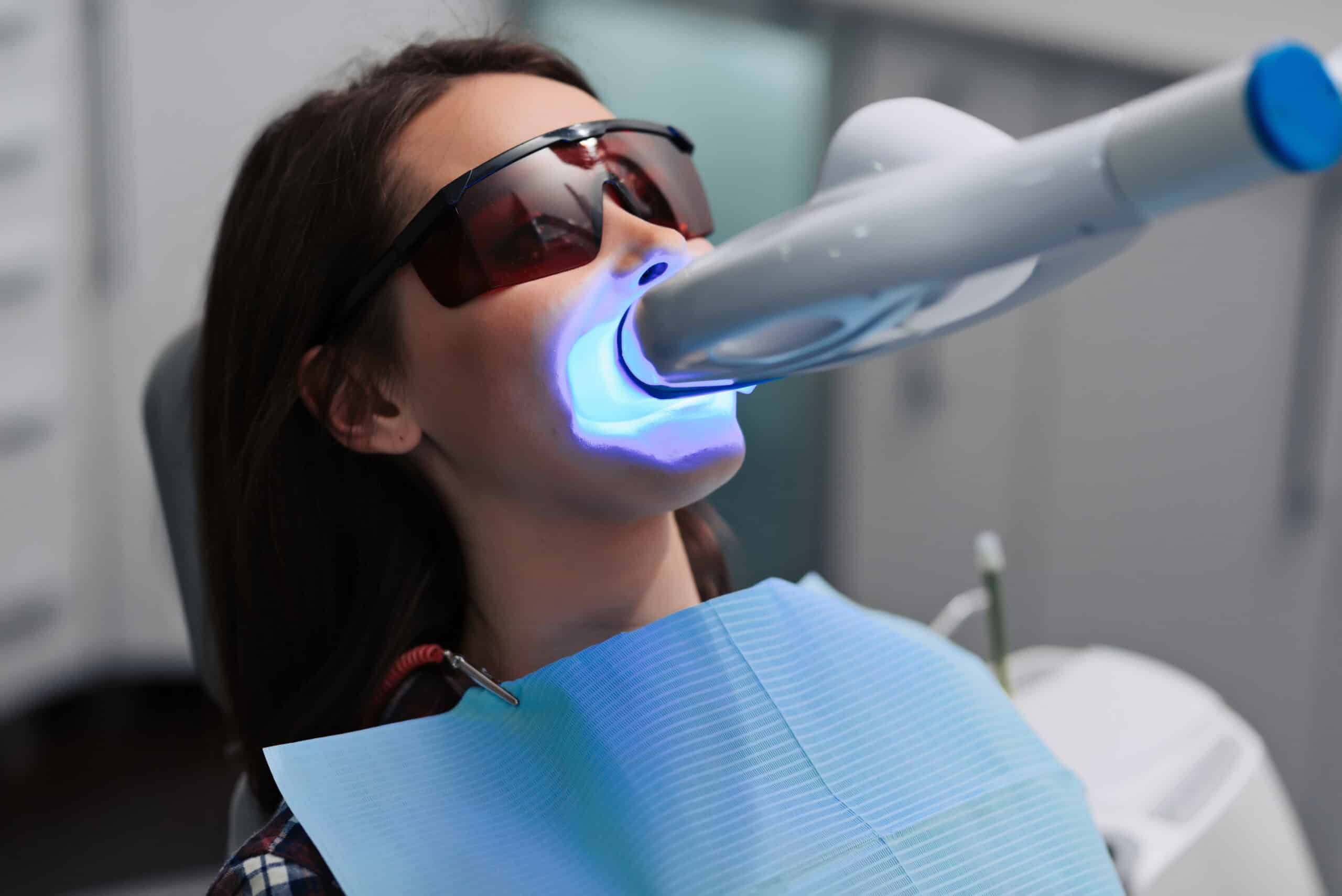 Laser Teeth Whitening treatment at BC Medical Aesthetic