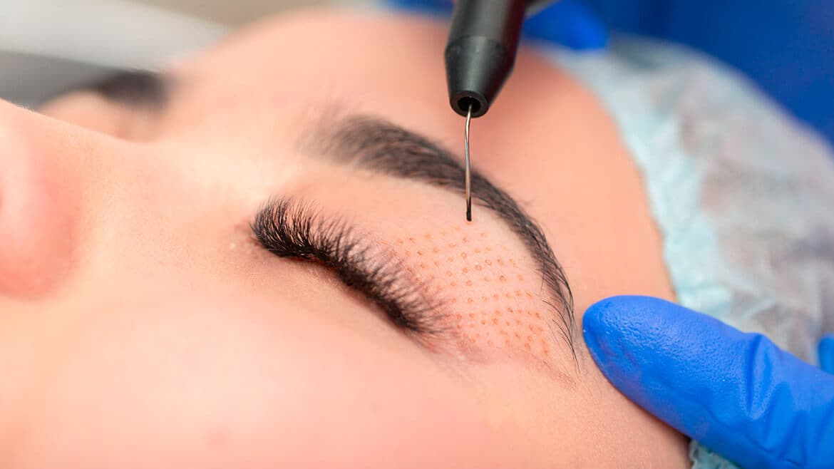 Plasma Pen Technician training at BC Medical Aesthetic